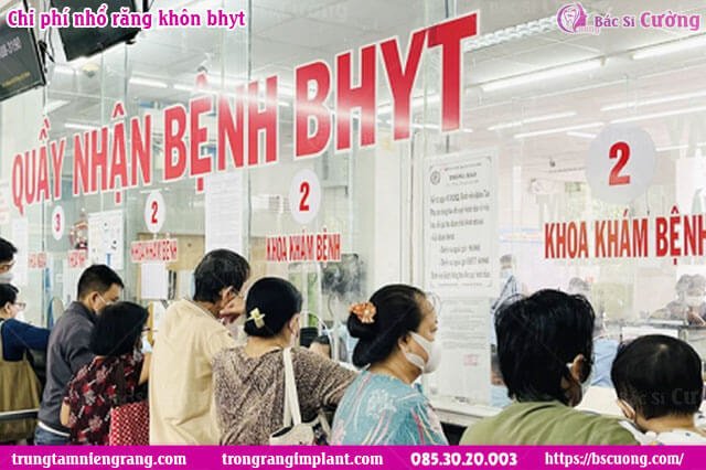 chi-phi-nho-rang-khon-bhyt-Bs-Cuong