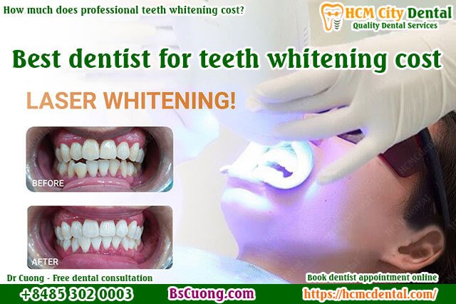 Good-dentist-for-teeth-whitening-cost-laser-whitening-drcuong-hcmcdental