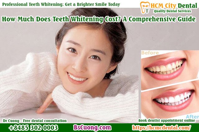 How-Much-Does-Teeth-Whitening-Cost-Professional-Teeth-Whitening-drcuong