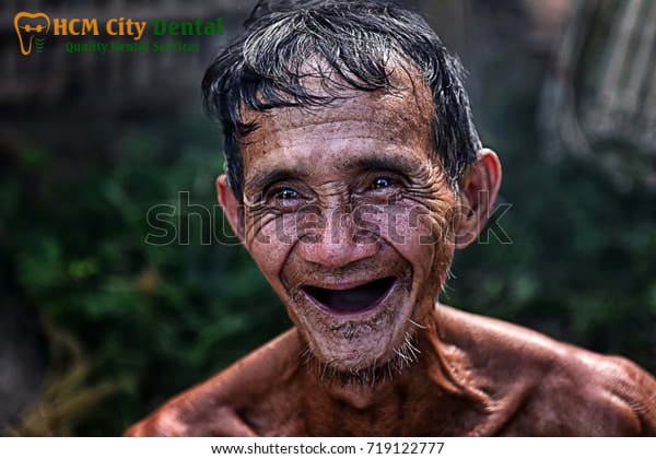 cuoi-khong-ho-rang-6-bac-si-cuong-nha-khoa-bscuong-bac-si-cuong-nha-khoa-bscuong