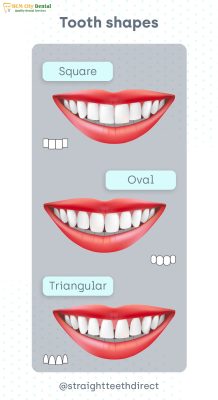 dang-rang-oval-1-bac-si-cuong-nha-khoa-bscuong