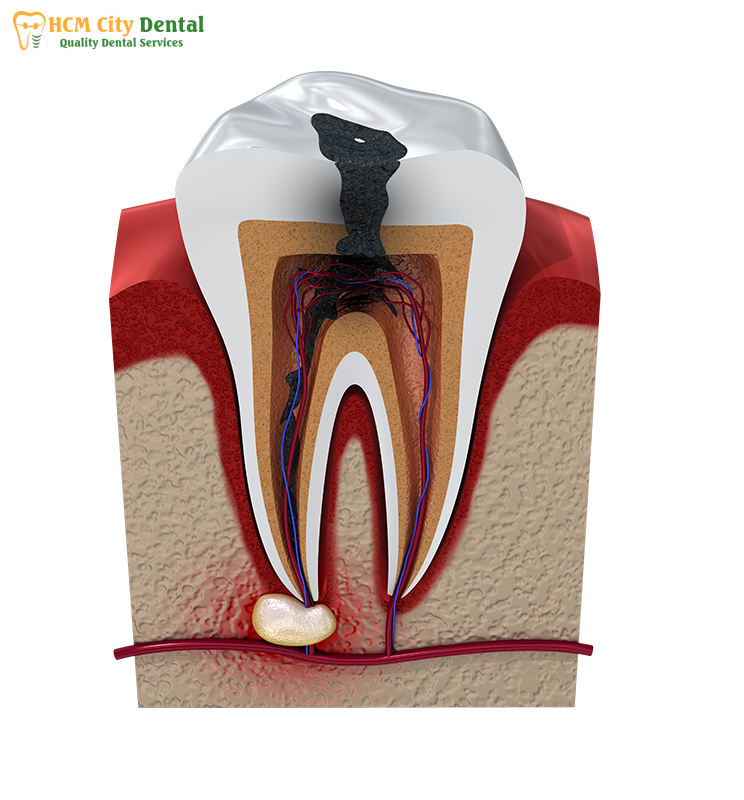 image-1-bs-cuong-bscuong.com