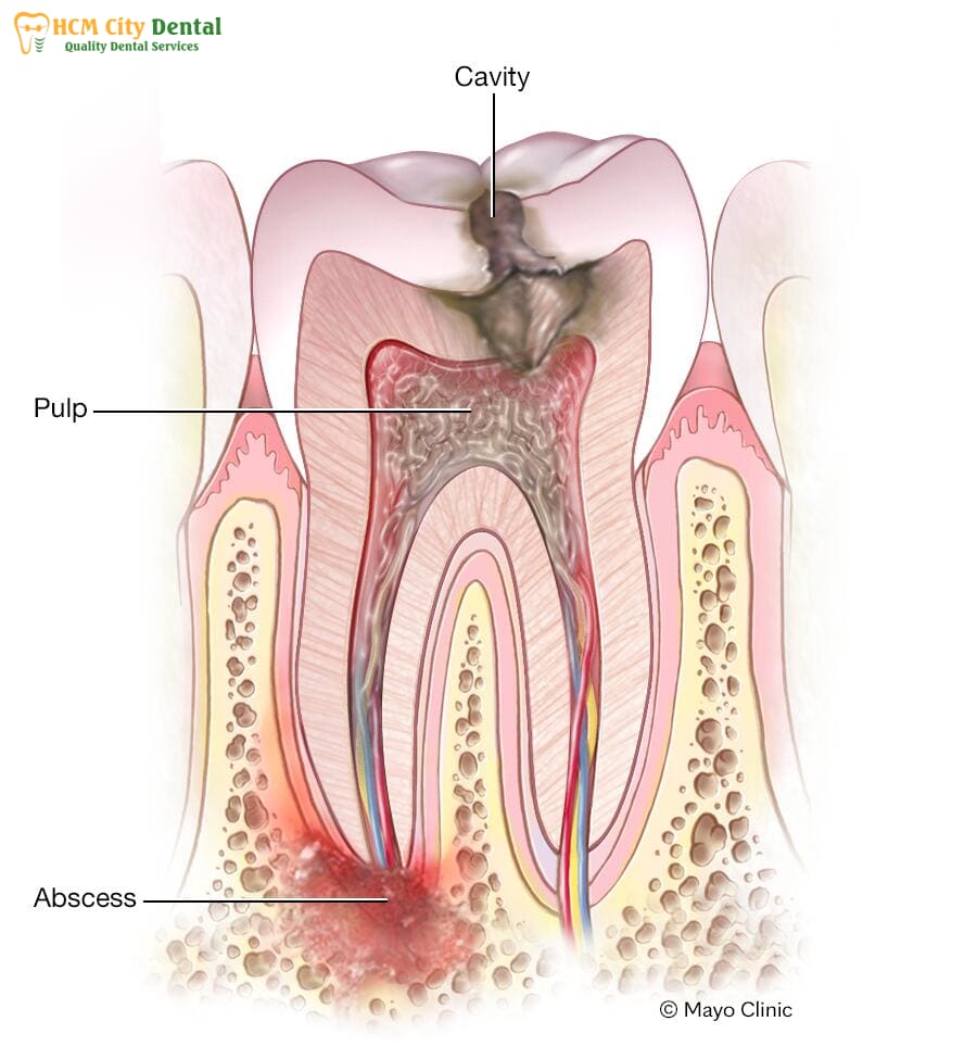 image-4-bs-cuong-bscuong.com