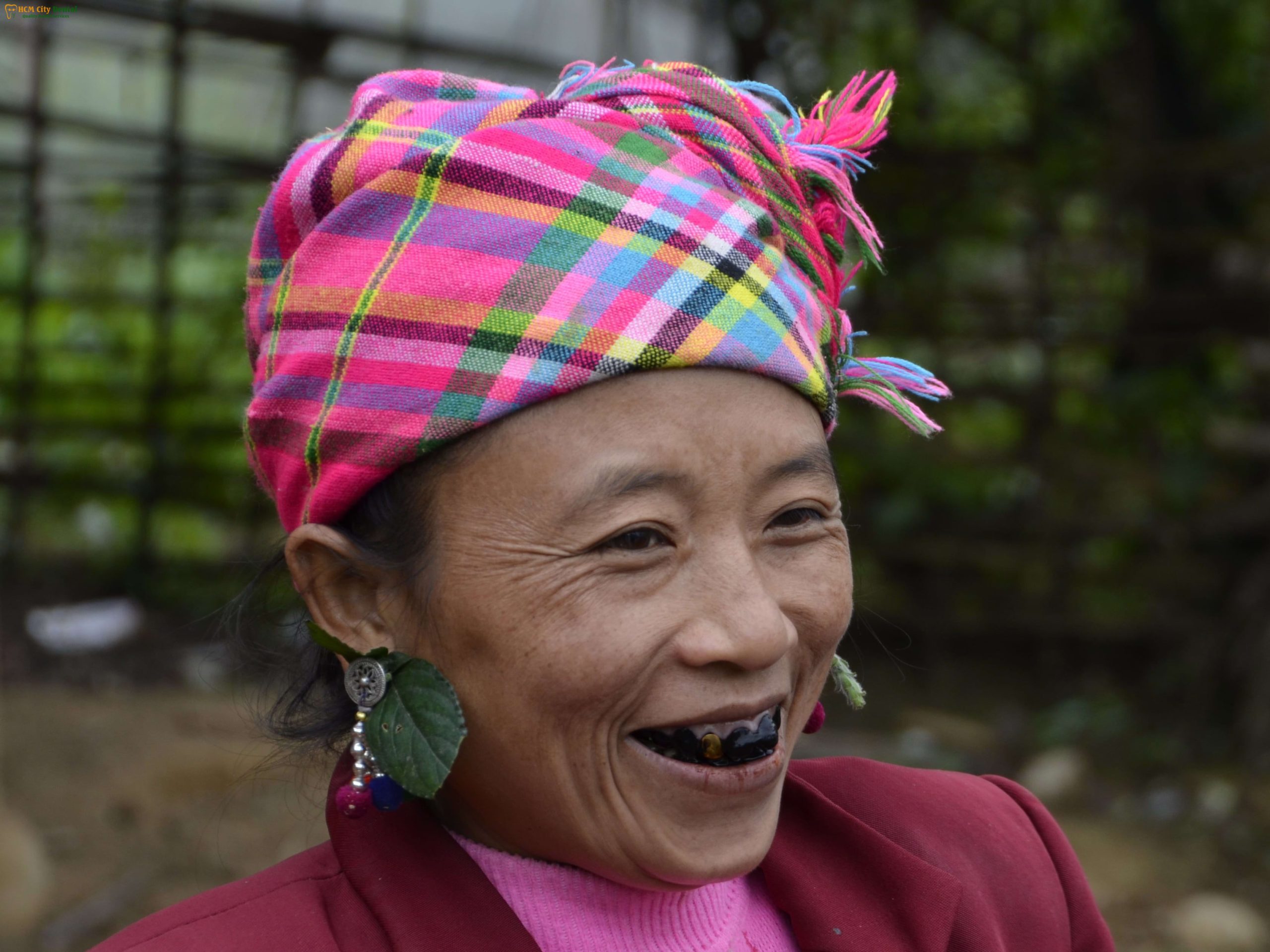 rang-bi-den-5-bac-si-cuong-nha-khoa-bscuong-bac-si-cuong-nha-khoa-bscuong
