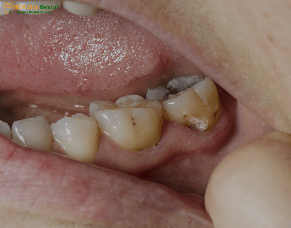 image-3-bs-cuong-bscuong.com