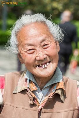cuoi-ho-rang-1-bac-si-cuong-nha-khoa-bscuong