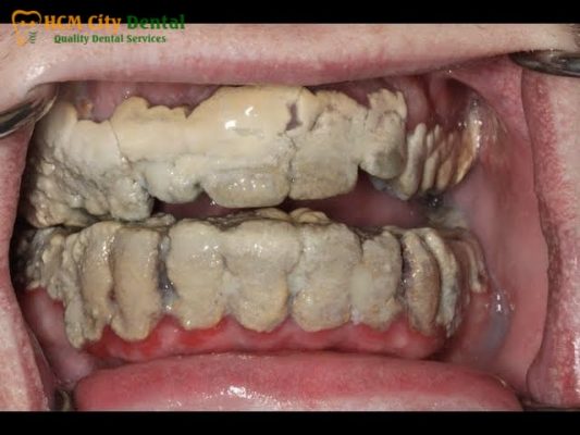 nguoi-co-40-cai-rang-1-bac-si-cuong-nha-khoa-bscuong