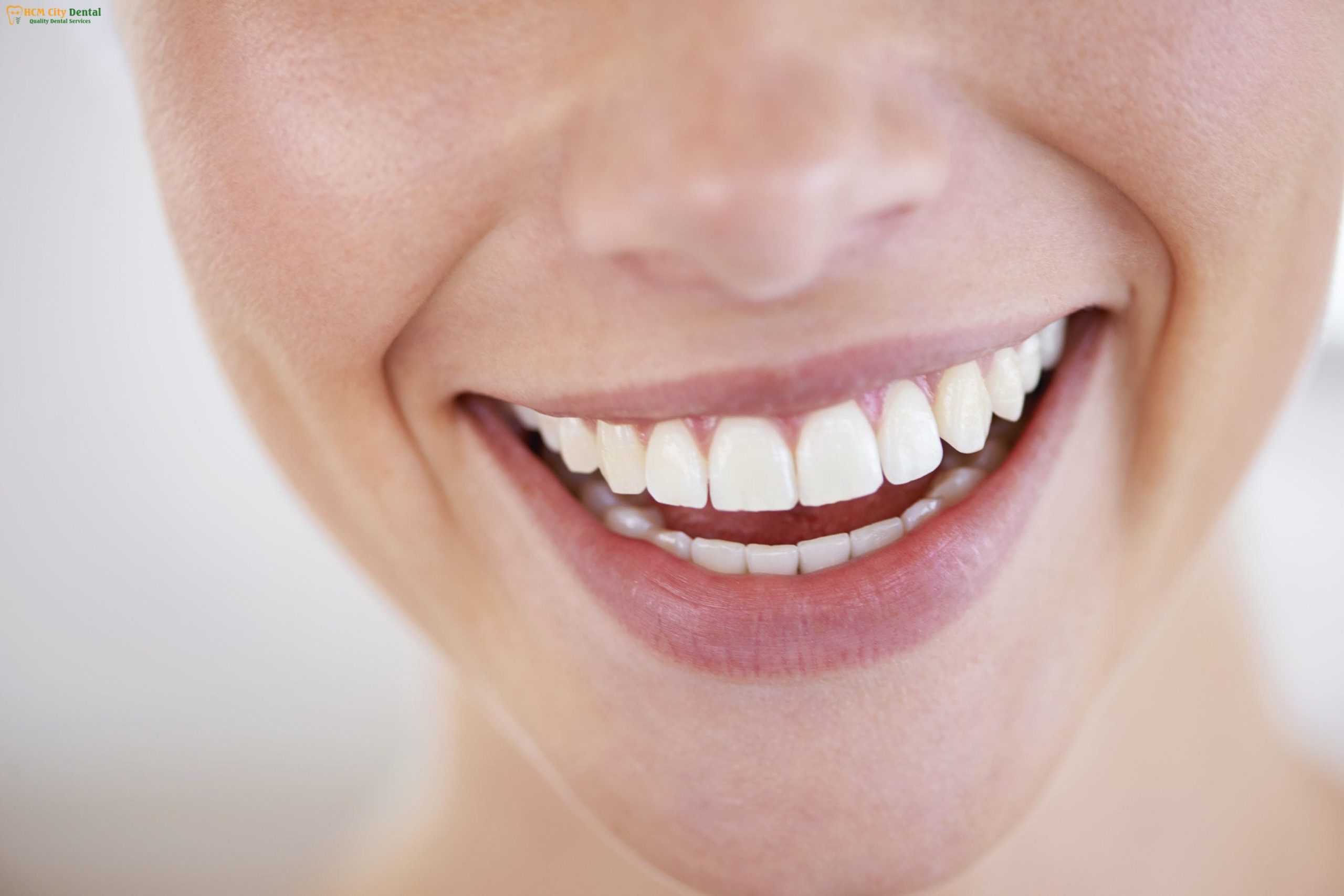 nhung-nguoi-rang-thua-5-bac-si-cuong-nha-khoa-bscuong-bac-si-cuong-nha-khoa-bscuong