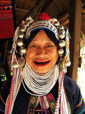 nhuom-rang-den-1-bac-si-cuong-nha-khoa-bscuong