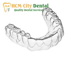 nieng-rang-trong-suot-clear-aligner-3-bac-si-cuong-nha-khoa-bscuong-bac-si-cuong-nha-khoa-bscuong