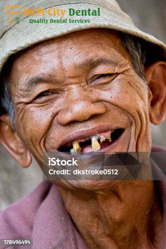 noi-chuyen-khong-ho-rang-3-bac-si-cuong-nha-khoa-bscuong-bac-si-cuong-nha-khoa-bscuong